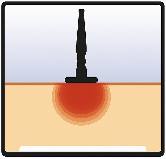 capacitiva