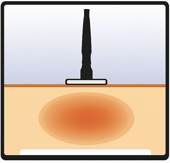 resistiva