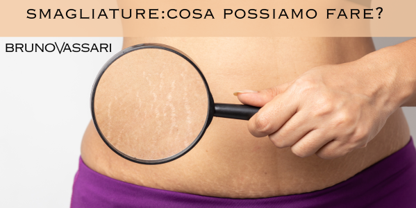 Smagliature: cosa possiamo fare davvero?